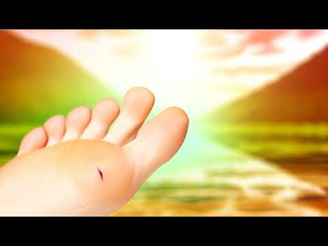 Mơ thấy chảy máu chân có thể liên quan đến sức khỏe và cảm xúc của bạn