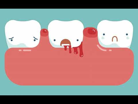Nằm Mơ Thấy Chảy Máu Răng: Ý Nghĩa & Các Con Số May Mắn